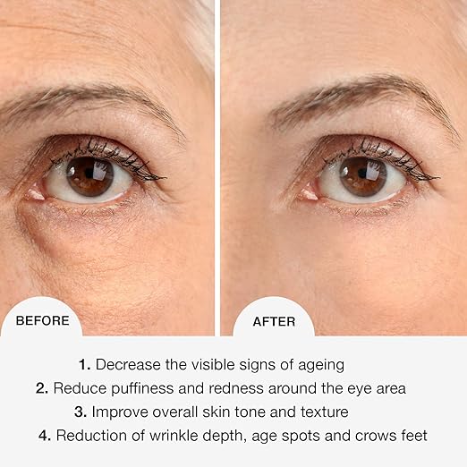 dermaset 3d rollerball