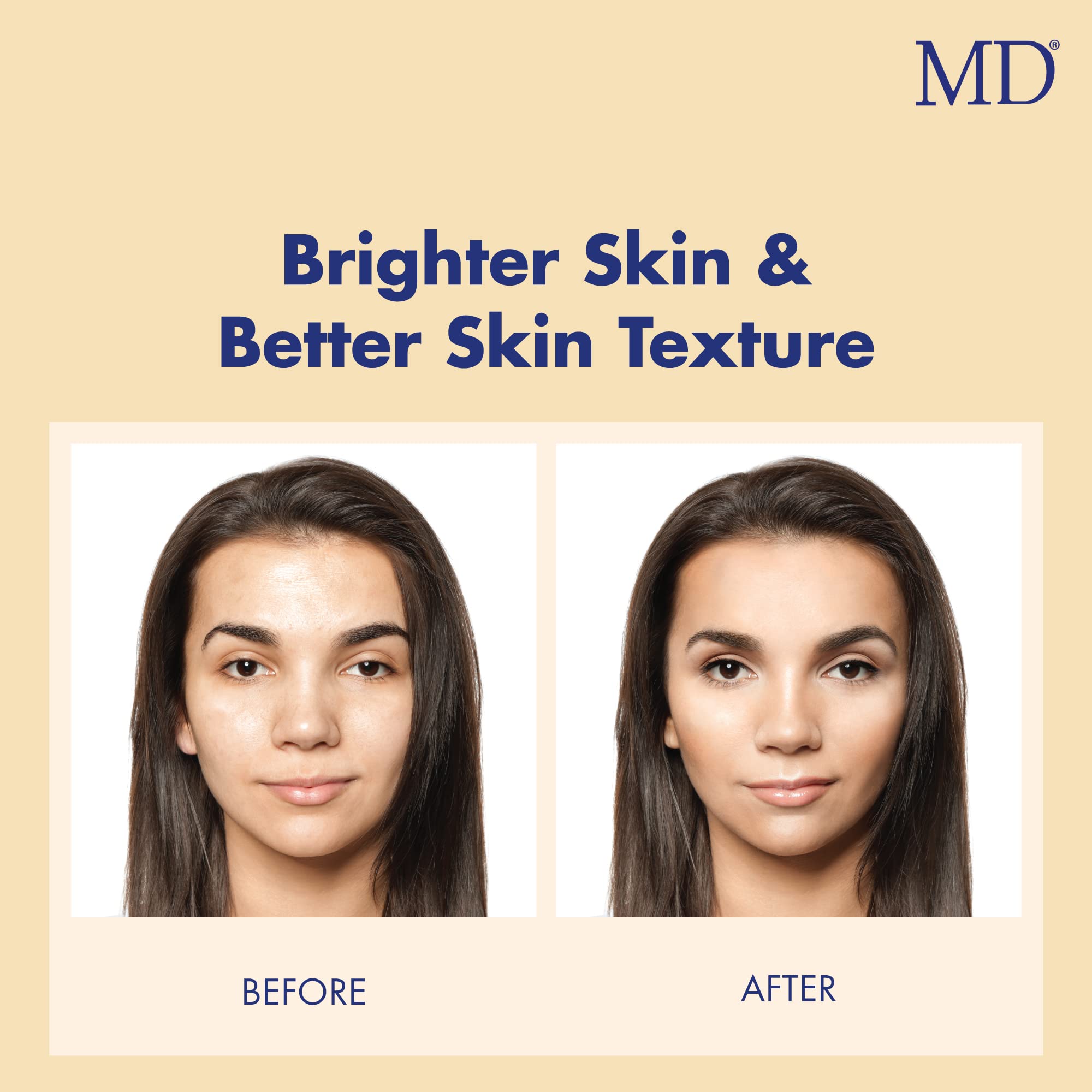 MD Factor Face Serum – Anti-Aging Face Serum with Vitamin C in L-Ascorbic Acid Form for Face & Body – Ideal for Fine Lines & Wrinkles Removal, Dark Spot Reduction & Collagen Production