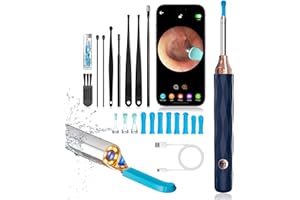 FEMOMETER FAMILY Ear Wax Removal, Ear Wax Removal Tool Camera with 6 Spoons, Ear Cleaner with Camera, 1080P Ear Scope, Earwax Removal Kit with with 6 LED Light