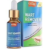 Liquid Wart Remover - Advanced Wart Treatment Lotion for All Warts Types Including Common and Genital - Painless and Fast-Acting