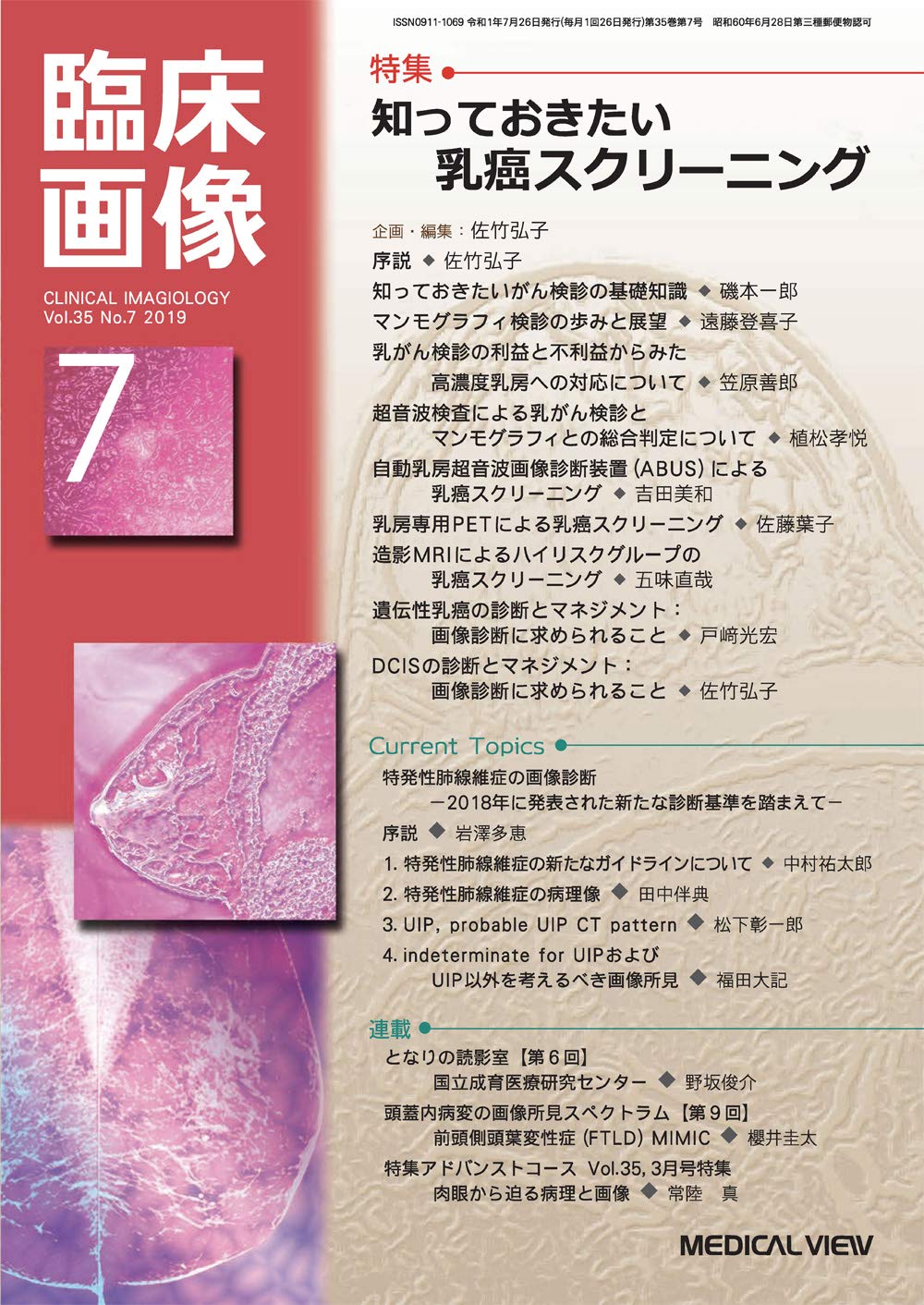 臨床画像 2019年7月号 特集 知っておきたい乳癌スクリーニング 本 通販 Amazon
