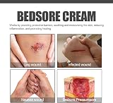 Akhand Bed Sore Cream 2Pcs Healing Ointment Wound Treatment view 5