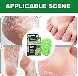 Bexdug Handmade Foot Soap Green Tea Oil for Jock Itch Athlete's Foot Softens view 4