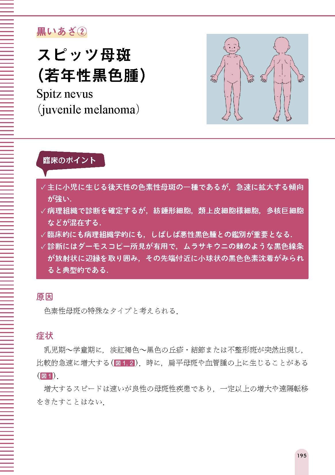 よくみる子どもの皮膚疾患 診療のポイント 保護者へのアドバイス ジェネラリストbooks 佐々木りか子 日野治子 馬場直子 佐々木りか子 本 通販 Amazon