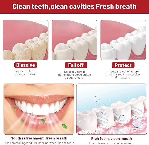 SP 10 PROBIOTIC TOOTHPASTE WHITENING – IMPROVE ORAL HEALTH WITH DENTAL PROBIOTIC FOR A BRIGHTER TOOTH (1)