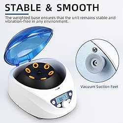 NORJIN PRP Lab Benchtop Centrifuge Machine