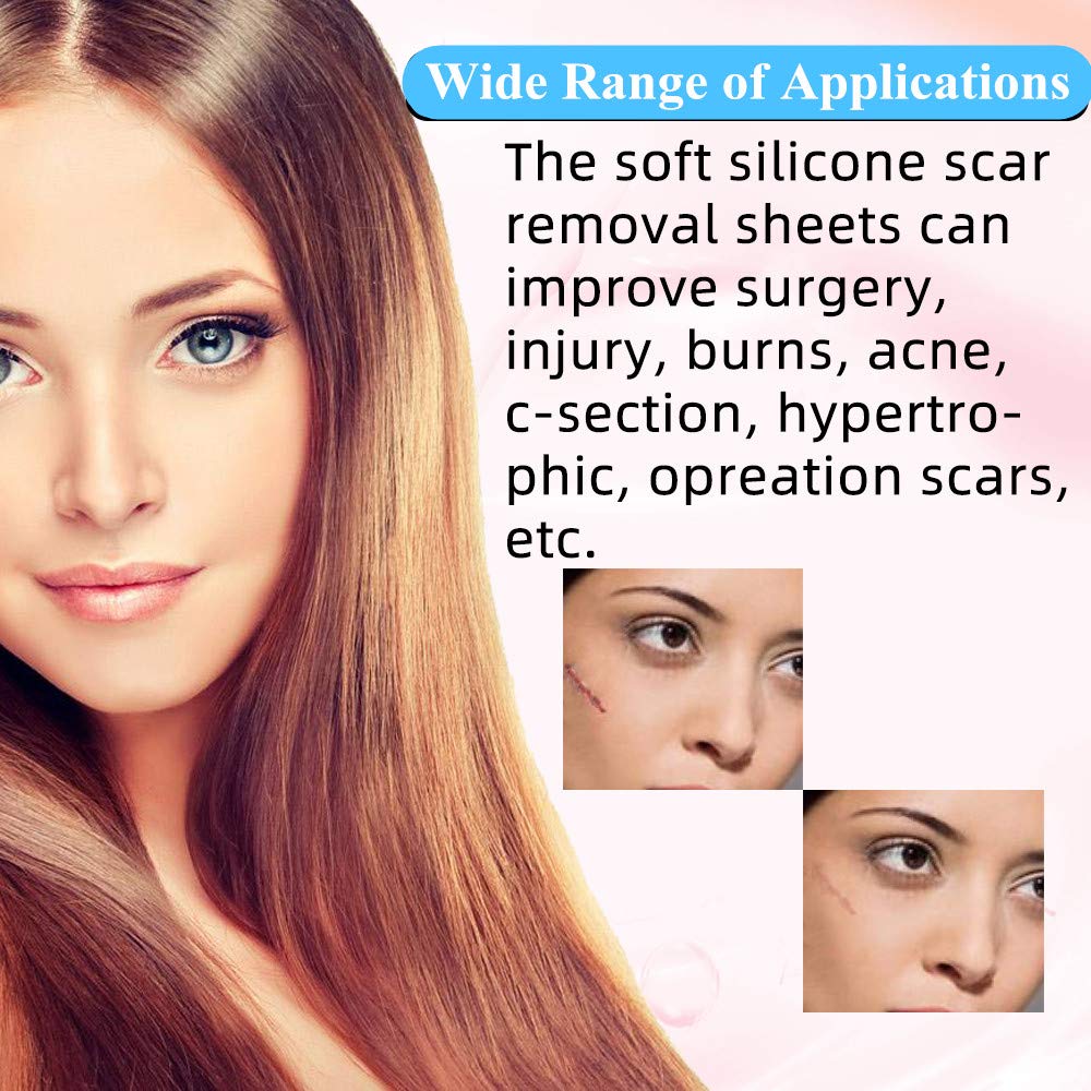 Professional Soft Silicone Scar Sheets, Prevents & Treats All Scars, Soften and Flattens Scars Resulting from C-section, Surgery, Injury, Burns, Acne, 5.9"×1.38", 5 Sheets(5 Months Supply)… : Beauty
