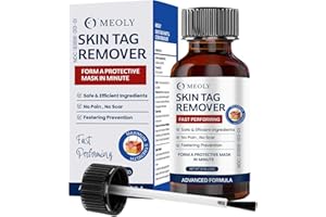 MEOLY Skin Tag Remover: Skin Tag Remover with Salicylic Acid for Men and Women