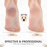 BRITS N STUFF 3 PCS Pedicure Foot File - Anti Rust Callus Remover view 5