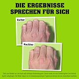 O'Keeffe's Working Hands Cream 90ml for Dry Rough Cracked Skin Hydration view 5