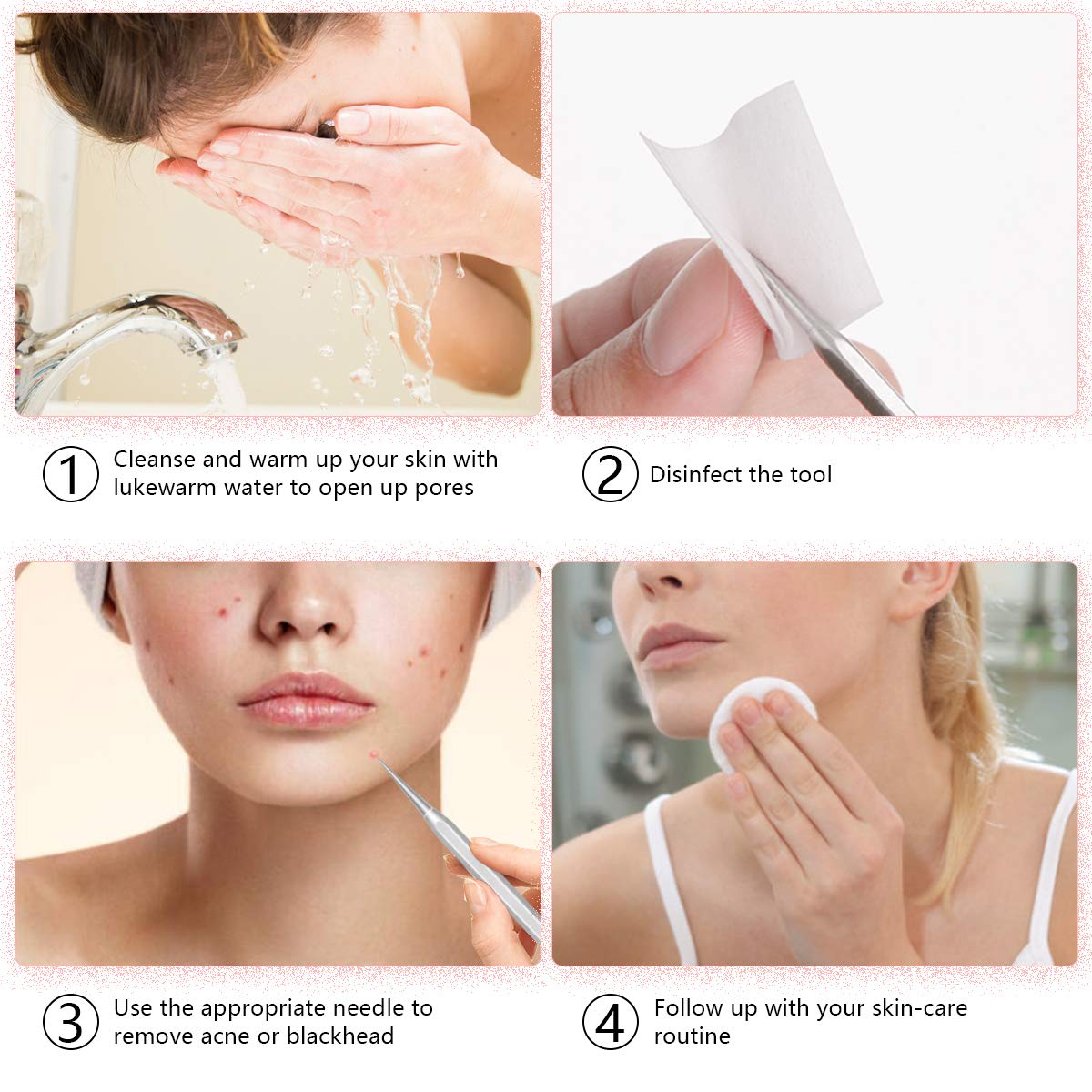 Pimple Popper Tool Kit,Blackhead Remover kit,christmas gifts Stocking Stuffers 6 PCS Ingrown Hair Removal Kit,White heads Removers,Pore Extraction Tool,Facial Skin Acne Zit Tools With A Leather Bag: Beauty