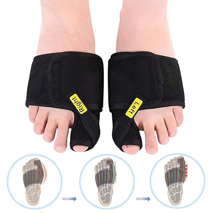 Doact Hallux Valgus Schiene(1 Paar) Hallux valgus Korrektur bandage Hilfe bei Hallux Valgus und Schmerzlinderung, Entzündeten