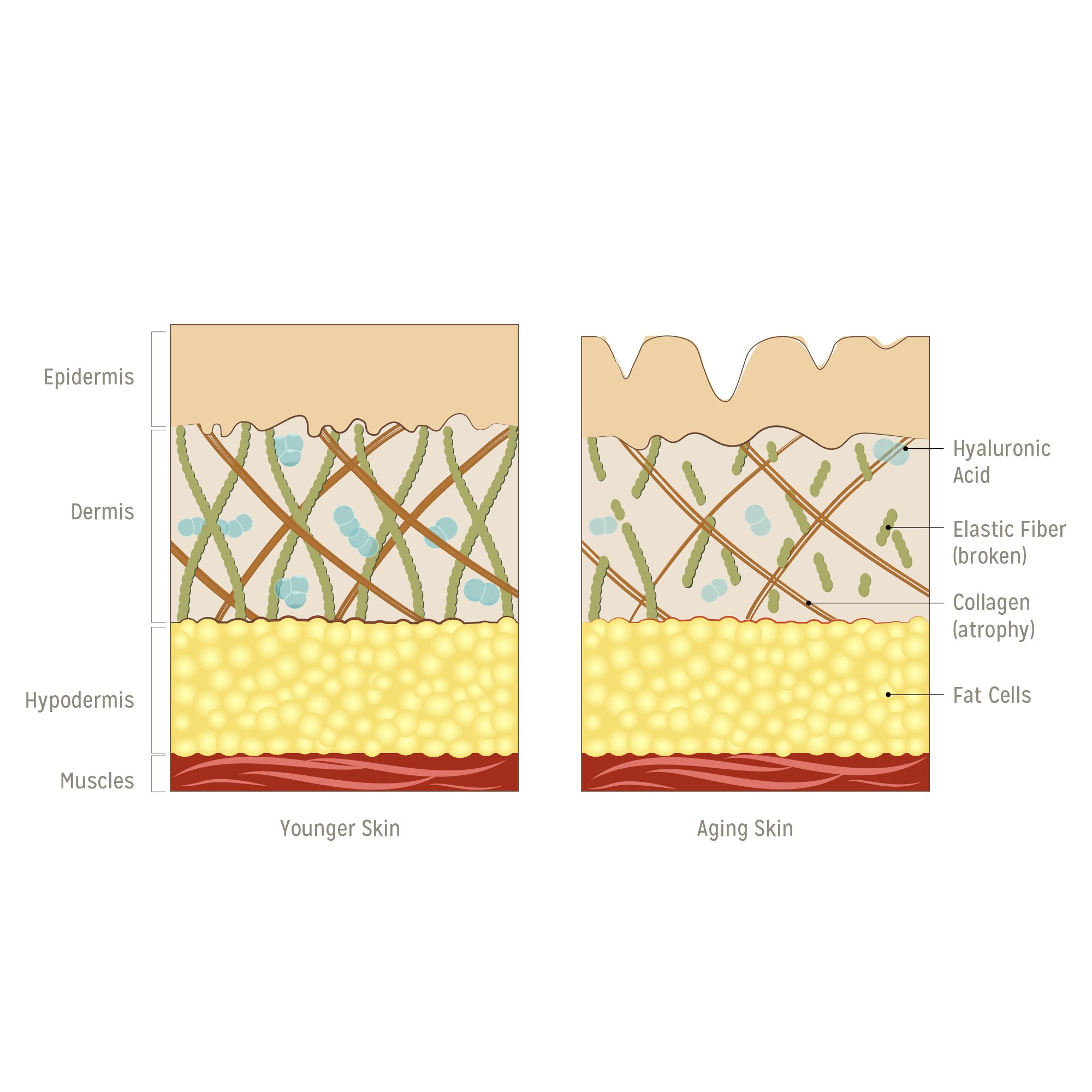 Calily Life Hyaluronic Acid Eye Gel + Vitamin E with Dead Sea Minerals, 1 Oz. – Deep Penetration Formula - Anti-Wrinkle and Anti-Aging - Minimizes Fine Lines, Puffiness and Dark Circles