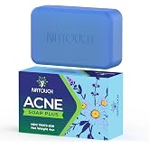 Natouch Acne Bar Soap for Face and Body, Medicated Soap Bar, 4 oz, 1 Pack | Acne Treatment Cleaning Soap Bar Treats Acne Pimples, Whiteheads, Blackheads, Acne Scars, Dark Spot Remover With Tea Tree Oil