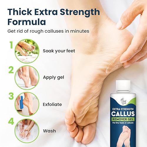 Callus Remover for Feet with Extra Strength Gel Foot Pumice