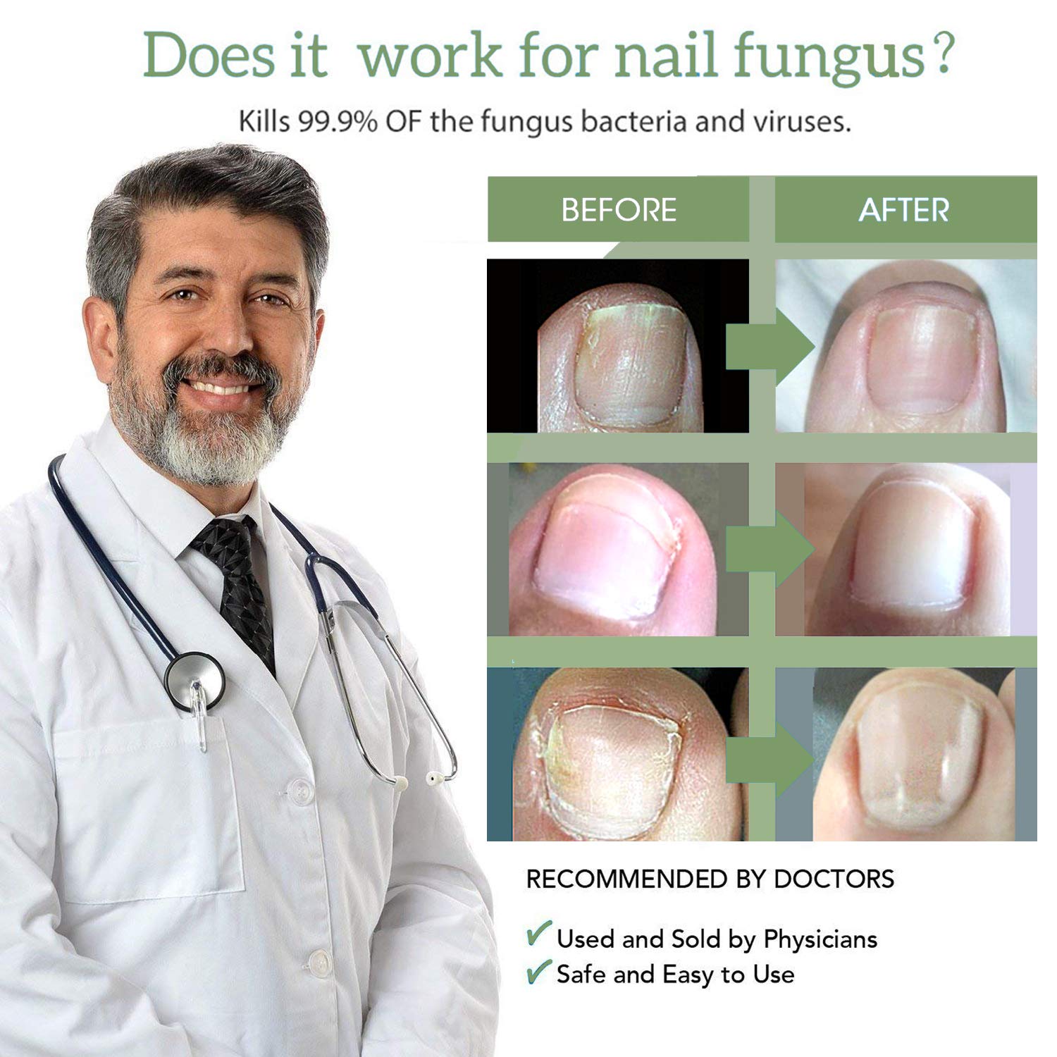 Fungus Treatment, Fungus Nail Repair Treatment for Brittle and Crack Fungus Toenail from Discoloration Fingernails Solution, Nail Repair Pen 3PCS : Beauty