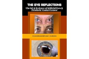 The Eye Reflections: The Art and Science of Artificial Eyes & Prosthetic Contact Lenses
