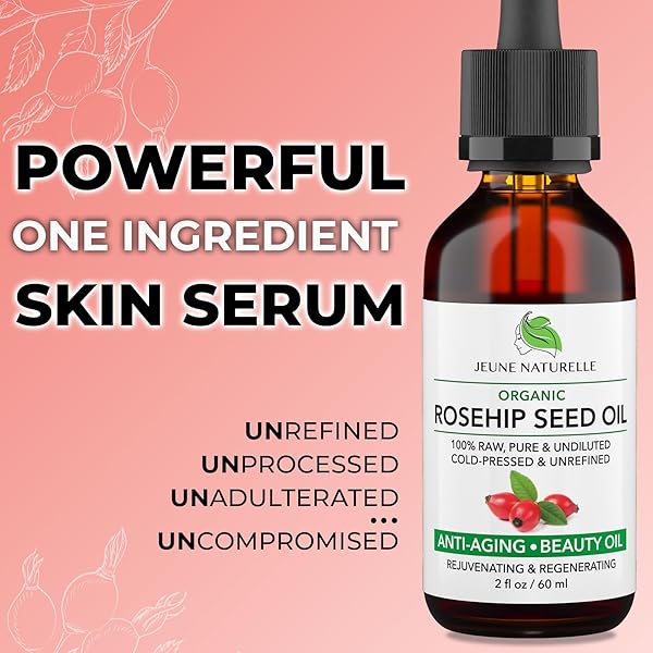 ROSEHIP OIL – PURE, VIRGIN, COLD PRESSED – FROM WHOLE BERRIES (PULP & SEEDS), NATURAL DEEP ORANGE HUE FOR INTENSIVE SKIN REPAIR – UNDILUTED ORGANIC ROSEHIP SEED OIL, 2 OZ