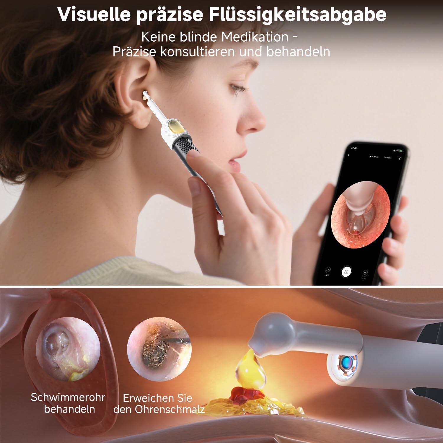 BEBIRD R1 Ultra Ohrenschmalz Entferner Kamera, Ohrenreiniger mit Otoskop für Zuhause, Komplett-Set mit Sichtbarer Dropper & Pinzette, Für Ohr & Nase & Rachen Untersuchung der Familie-Schwarze 4