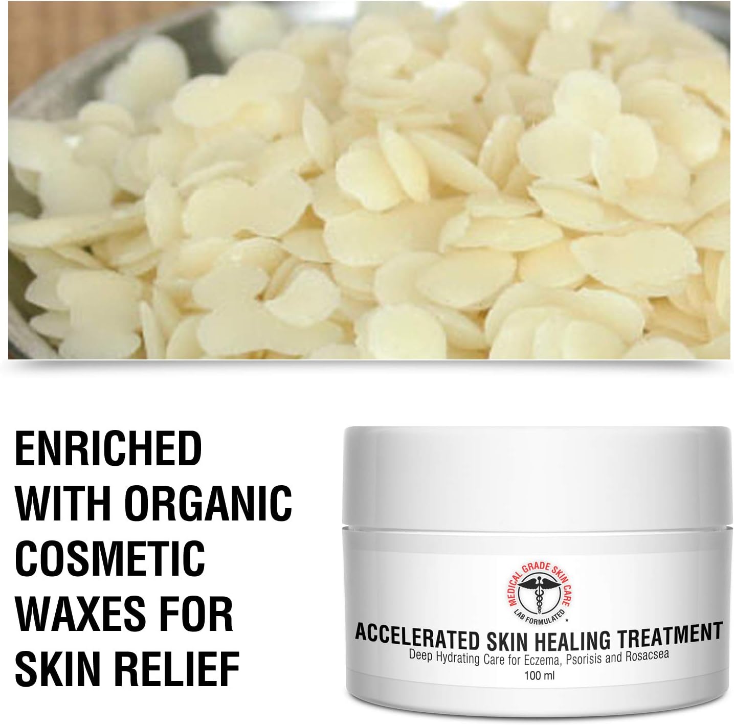 Eczema, Rosacea, Dermatitis, and Psoriasis Cream - Medical Grade Accelerated Skin Healing Treatment, Deep Hydrating Skin Lotion, Instant Skin Relief: Health & Personal Care