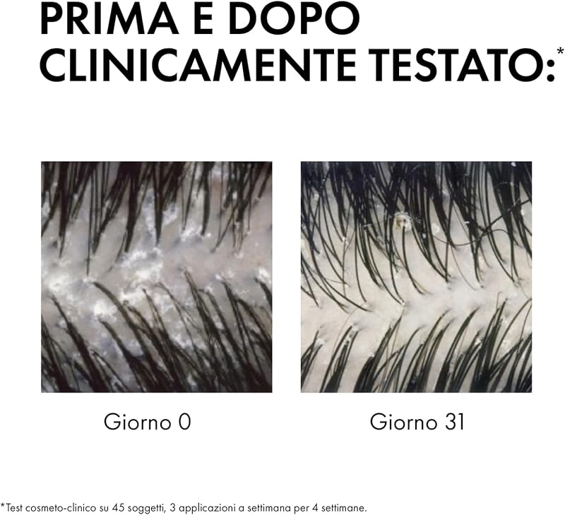 Dercos, Shampoo Anti-Forfora DS, Per Capelli da Normali a Grassi, Azione Riequilibrante, Effetto Anti-Ricomparsa, Arricchito con Disolfuro di Selenio e Acido Salicilico, 200 ml