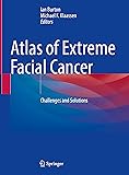 Atlas of Extreme Facial Cancer: Challenges and