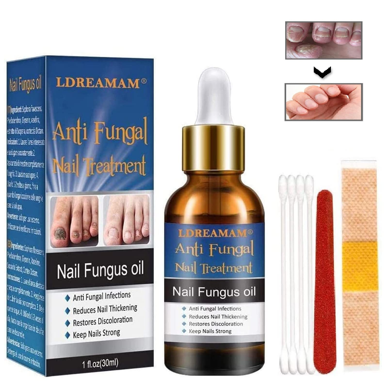 Antifungal Nail Repair,Fungal Nail Care,Nail Treatment,Nail Care Solution to Repair Damaged,Cracked and Discolored Nails.