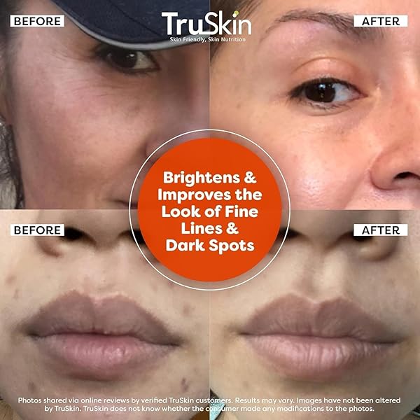 TRUSKIN VITAMIN C SERUM FOR FACE – ANTI AGING FACE SERUM WITH VITAMIN C, HYALURONIC ACID, VITAMIN E – BRIGHTENING FORMULA – IMPROVE APPEARANCE OF DARK SPOTS, TONE, FINE LINES & WRINKLES, 1 FL OZ