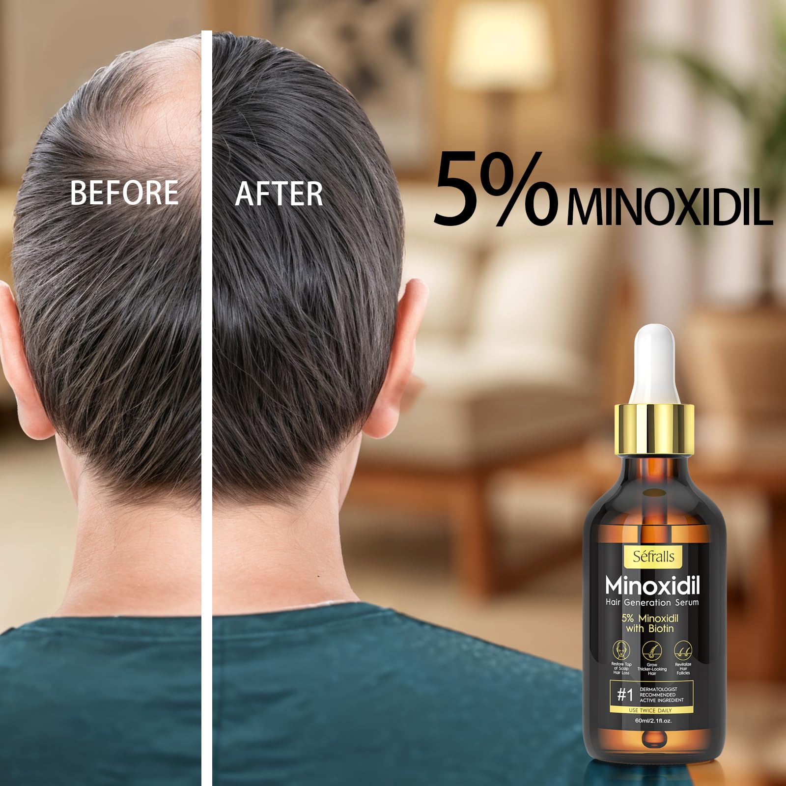 5% Minoxidil Hair Growth Serum Oil For Men and Women, Biotin Hair Serum, Safest Hair Regrowth Treatment, Prevent Scalp Hair Loss 60ml / 2.11 fl.oz