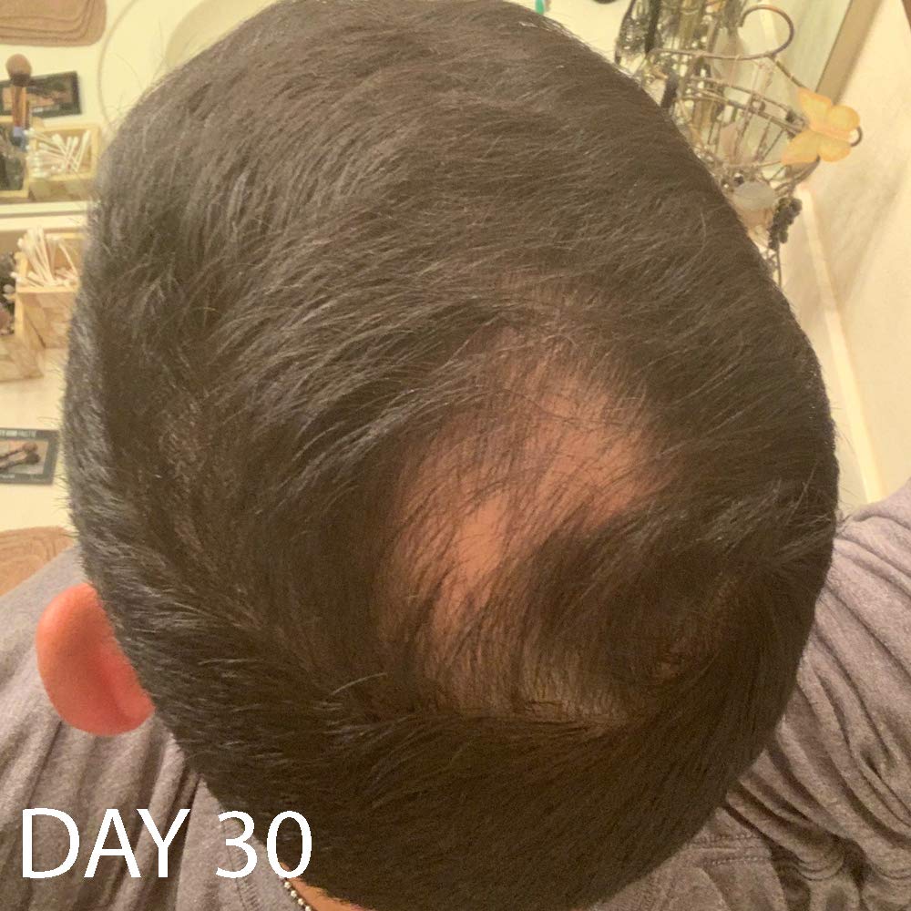 Biotin Vitamin Hair Growth Conditioner-(High Potency) Biotin Conditioner For Fastest Hair Growth, Anti Hair Loss Conditioner, Vitamins E, A, And C, B. THE PRODUCT: Beauty