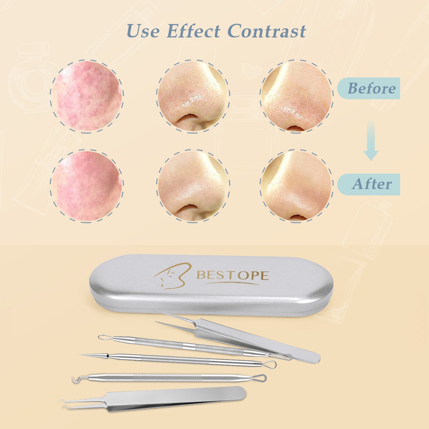 BESTOPE Blackhead Remover Upgraded 6-in-1 Pimple Comedone Extractor Tool Acne Removal Kit - Treatment for Blemish, Whitehead Popping, Zit Removing for Risk Free Nose Face Skin - Silver: Beauty