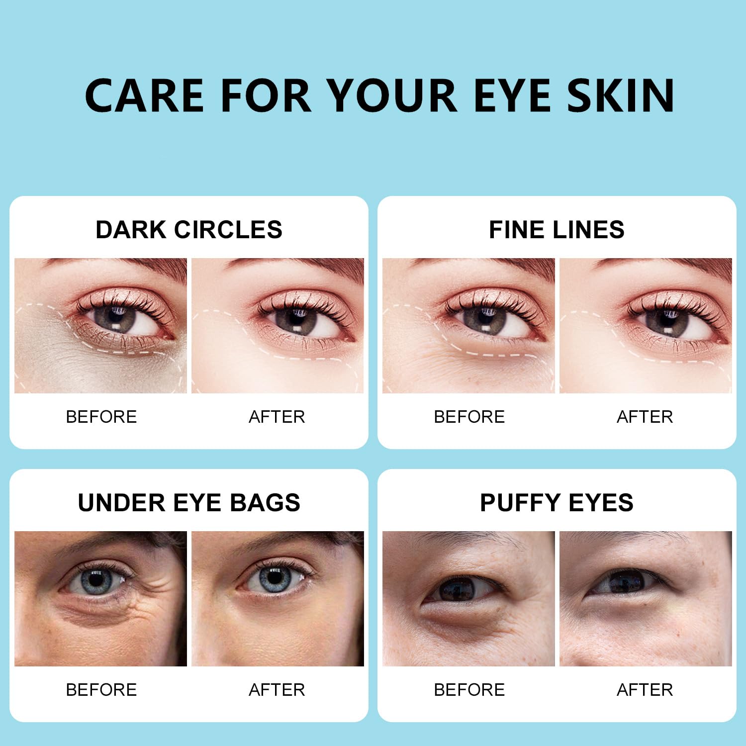 ROUSE Snail Extract Collagen Under Eye Patches with Hyaluronic Acid Anti-Aging Eye Mask Under Eye Bags Dark Circle Removal Moisturizing Repairing Friming Eye Gel Treatment Mask-60pcs