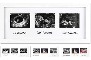 IHEIPYE Triple Sonogram Pregnancy Frame - Baby Ultrasound Picture Frame for Expecting Parents, Baby Shower Frame, Gender Reveal Party, Baby Nursery Decor, White
