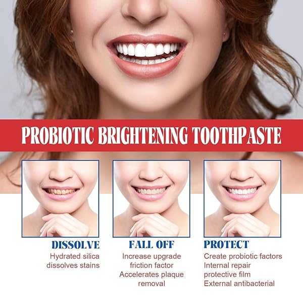 XIGUA SUPER PROBIOTIC-6 TOOTHPASTE, SP-6 ULTRA WHITENING TOOTHPASTE, SP 6 TOOTHPASTE, DEEP CLEANING CARE TOOTHPASTE, FRESH BREATH, SUPER PROBIOTIC-6 TOOTHPASTE(1PCS TOOTHPASTE + 1PCS TOOTHBRUSH)