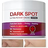 Jtopyrt Dark Spot Cream: Brightening Treatment Diminishes Age Spots, Sun-Damage, Liver Spots, Freckles & Discoloration For Younger Looking Skin - Fader & Corrector For Face, Chest, Hands & Body - 50ml