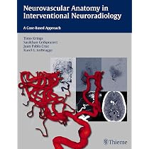 Decision Making in Neurovascular Disease | Amazon.com.br