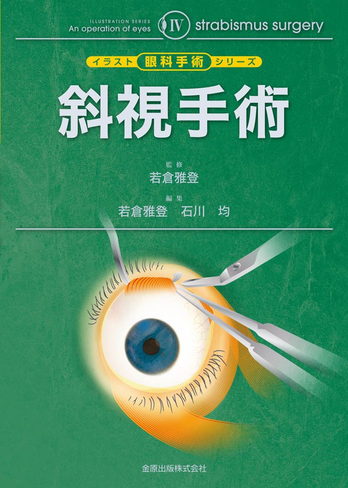 イラスト眼科手術シリーズiv 斜視手術 Amazon Com Books