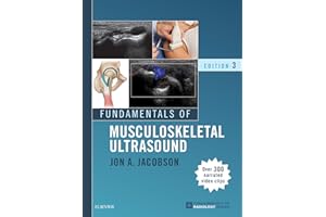 Fundamentals of Musculoskeletal Ultrasound E-Book (Fundamentals of Radiology)