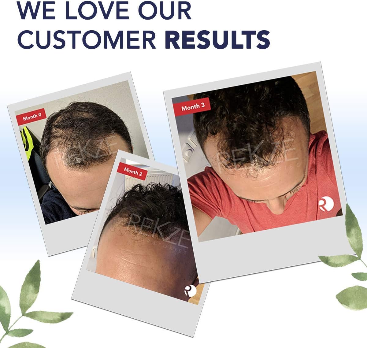 REKZE 24 Serum w/Unique Premium Clinically Proven Formula for Hair Thickening Anti-Hair Loss & Thinning - Image 4