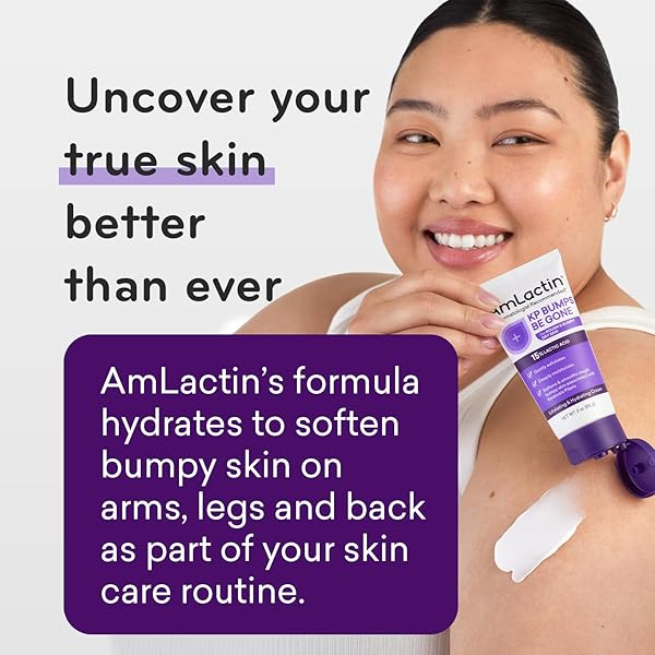 AMLACTIN KP BUMPS BE GONE – 3 OZ KERATOSIS PILARIS MOISTURIZING CREAM WITH 15% LACTIC ACID – EXFOLIATOR AND MOISTURIZER FOR DRY, ROUGH AND BUMPY SKIN (PACKAGING MAY VARY)