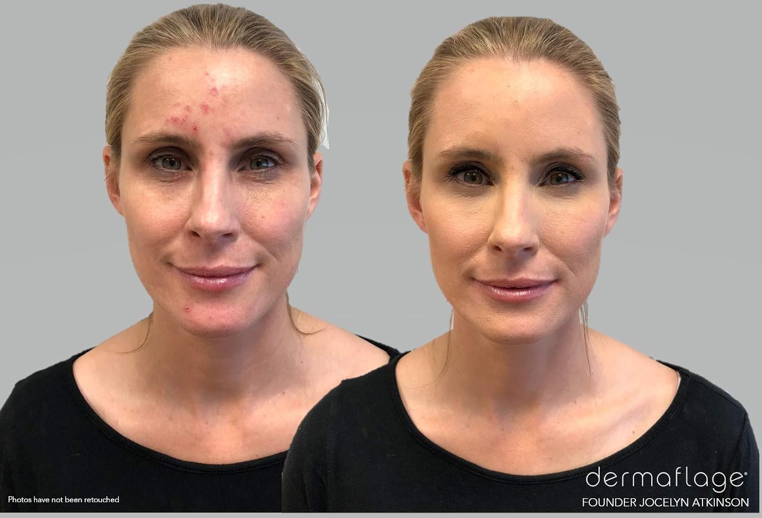 Dermaflage Waterproof Concealer Cream (Medium), Concealer Full Coverage, Matte Finish for Face & Body, Hides Dark Circles - Image 3