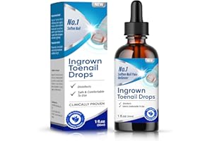MOSKILA Ingrown Toenail Treatment, 30 ml Fast & Effective Ingrown Toenail Corrector Drops, Ingrown Toenail Softener for Nails Easy Trimming