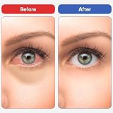 Zelerc Eye Spray Pack of 2 & 20 Cotton Pads for Dry, Tired Eyes view 5