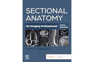 Sectional Anatomy for Imaging Professionals - E-Book