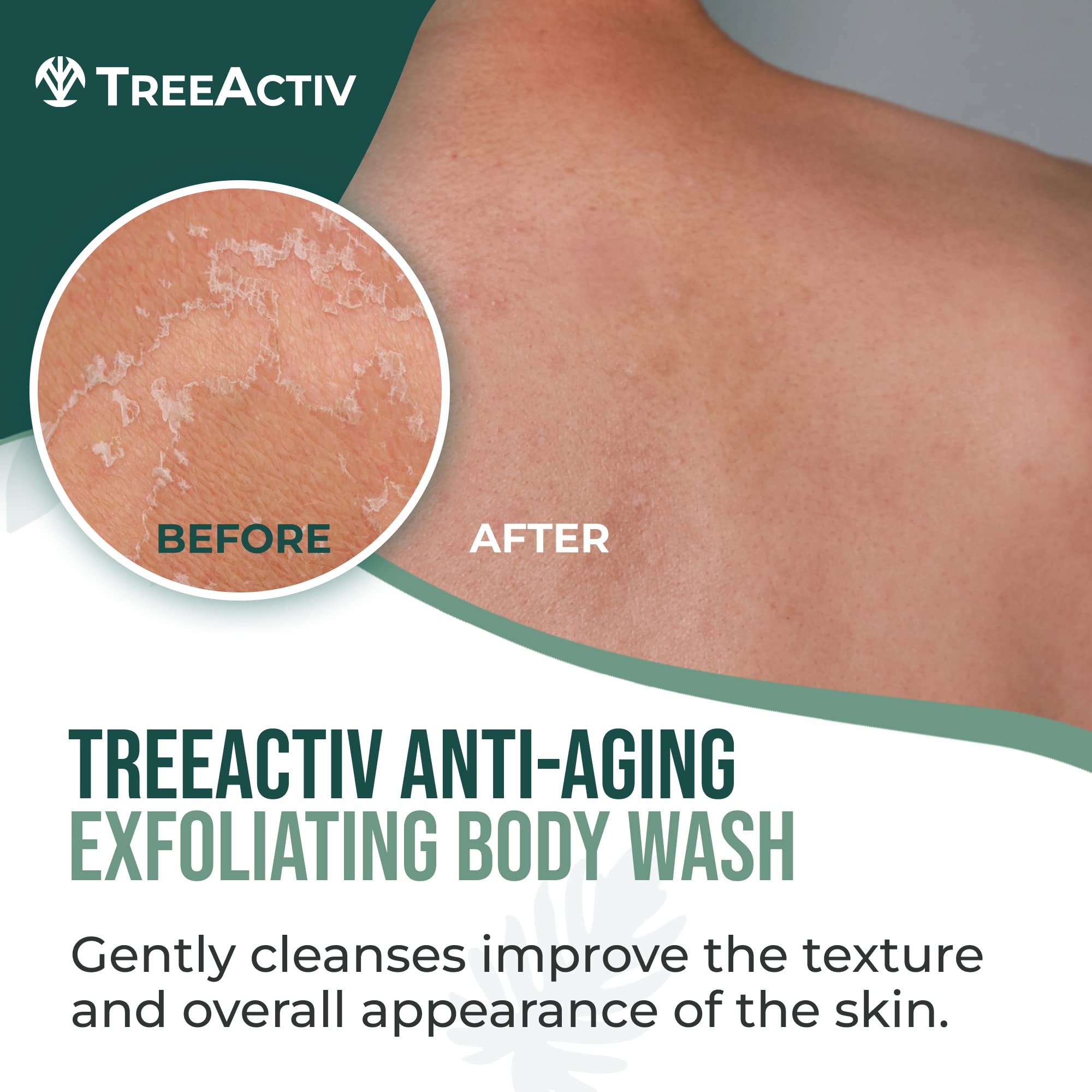 TreeActiv Anti-Aging Exfoliating Body Wash, 8oz, All Natural Body Wash Women and Men, Exfoliating Body scrub Infused with Jojoba Beads, Sulfur, and Aloe Vera - Shower Gel For All Skin Types - 50 Uses
