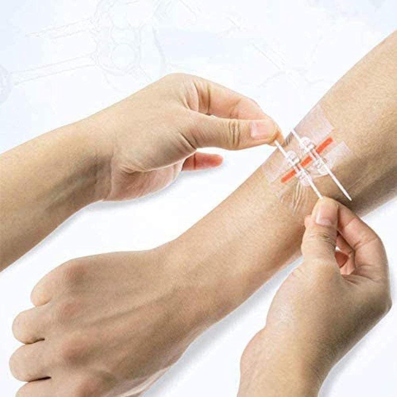 2PCS Zipper SutureFree Band Aid Wound Closure Device