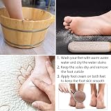 Msxenophile 3Pcs Pumice Stone Foot File for Hard Skin Calluses Pedicure view 7