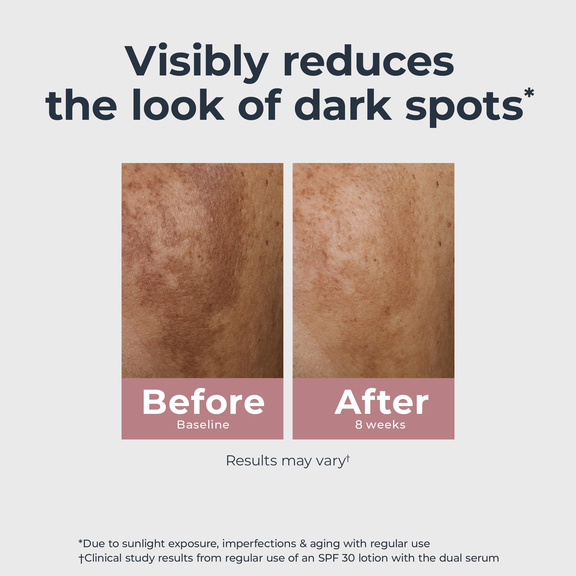 Eucerin Radiant Tone Dual Serum Dark Spot Corrector, Dark Spot Serum with Thiamidol and Hyaluronic Acid, Helps Visibly Reduce the Look of Dark Spots, Holiday Gifts for Self Care, 1 Fl Oz Bottle