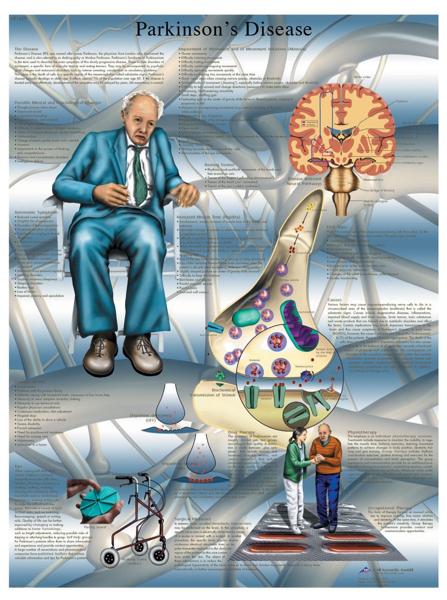 3B Scientific Parkinsons Disease Chart Laminated Version