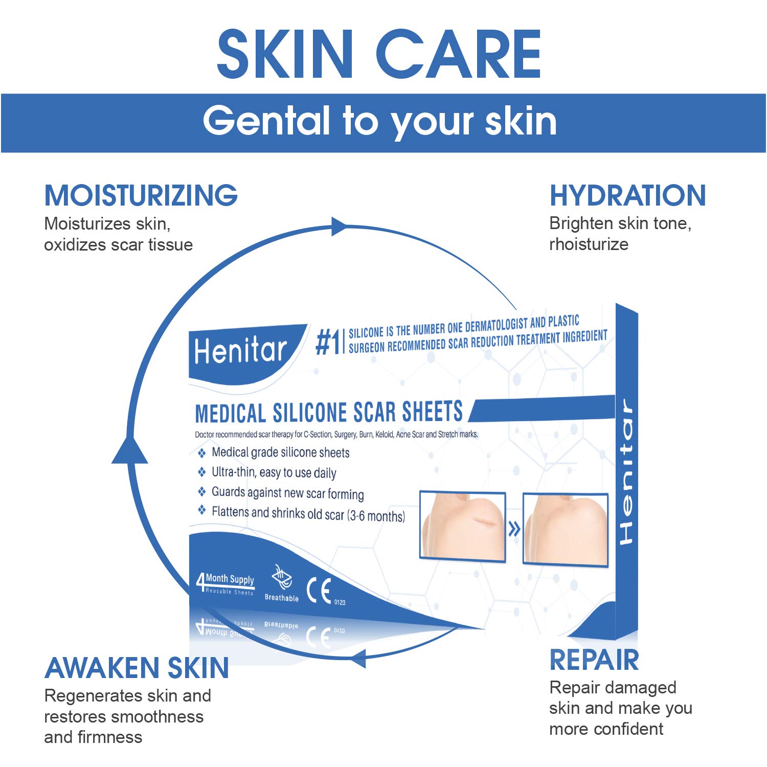 HENITAR Medical Silicone Scar Sheets, Soften and Flattens Scars, Ideal for Stretch Marks, Works on Old & New Scars, C-Section, Surgery, Burn, Injuries, Acne, and more scars, 5.7"×1.57” : Beauty